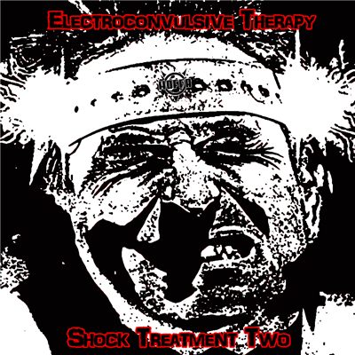 Electroconvulsive Therapy - Shock Treatment Two art